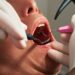 Boca abierta en dentista