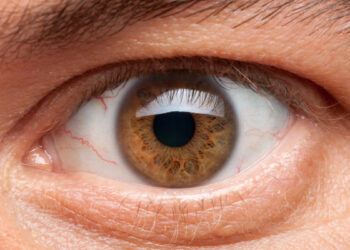 tension-ocular