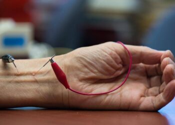 acupuntura presiion arterial