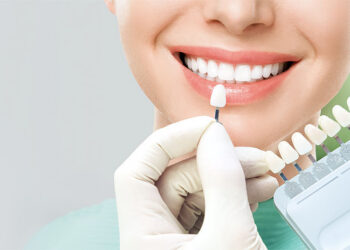 dientes blancos