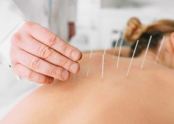 ¿Cómo funciona la terapia con acupuntura y por qué es beneficiosa para la salud?