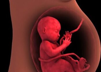 Placenta previa: Causas, tipos y síntomas
