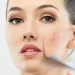 Consejos infalibles para lucir una piel sin imperfecciones