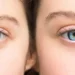 Cataratas oculares: hábitos saludables para conservar la visión
