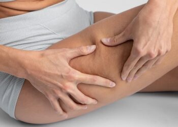 Adiós a la celulitis rebelde: ¿Por qué el ejercicio y la dieta a veces no son suficientes?