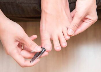 Los errores más comunes al cortar las uñas de los pies (y cómo evitar las uñas encarnadas)